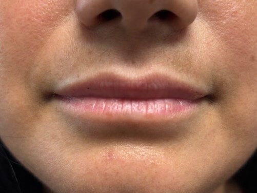 Before Image