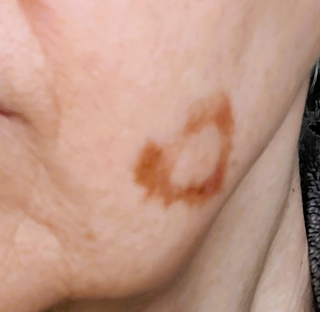 Before Image