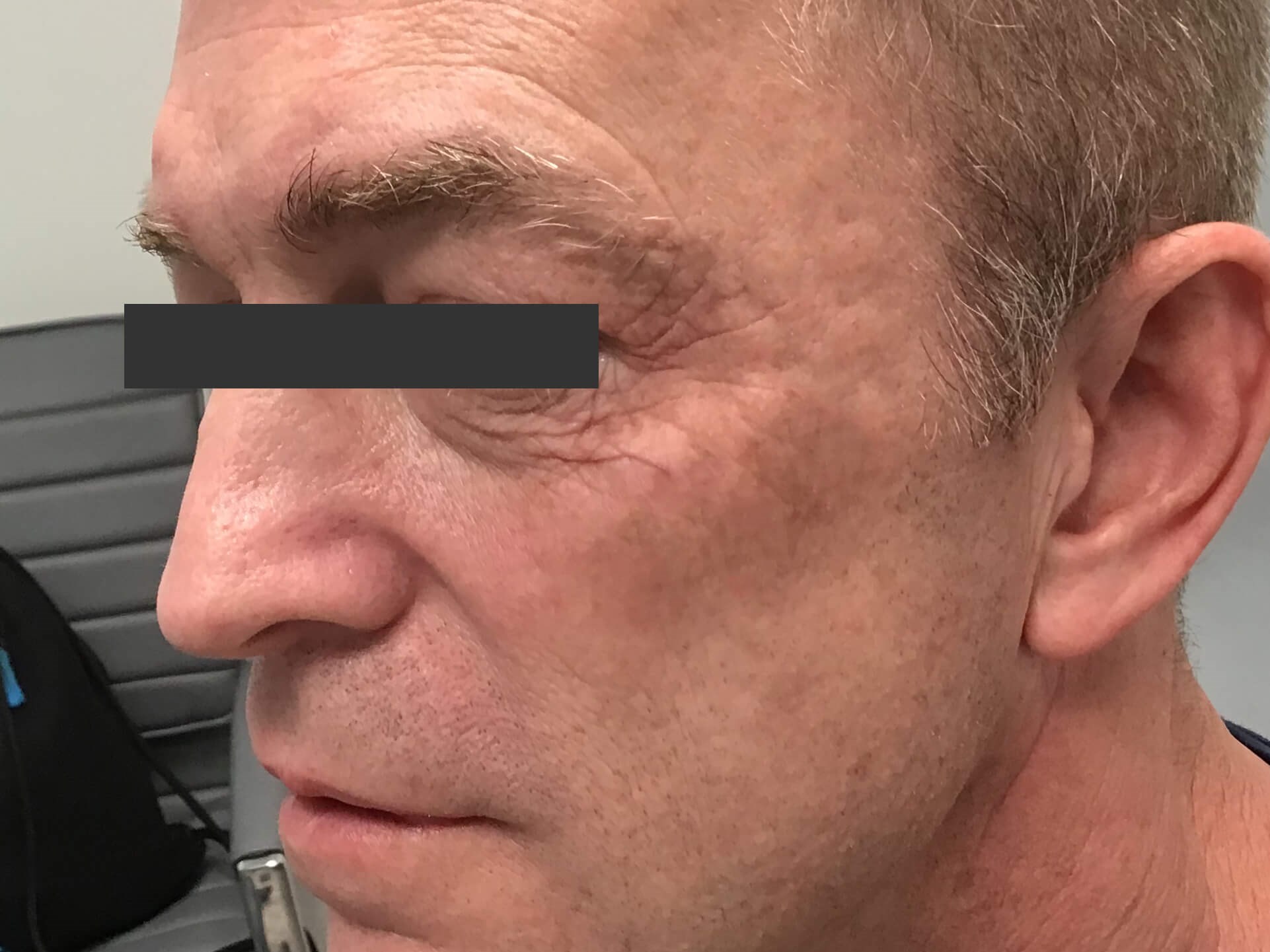 After Image