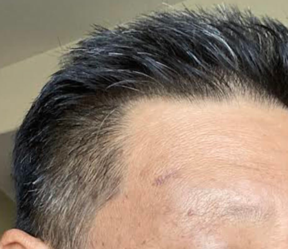 After Image
