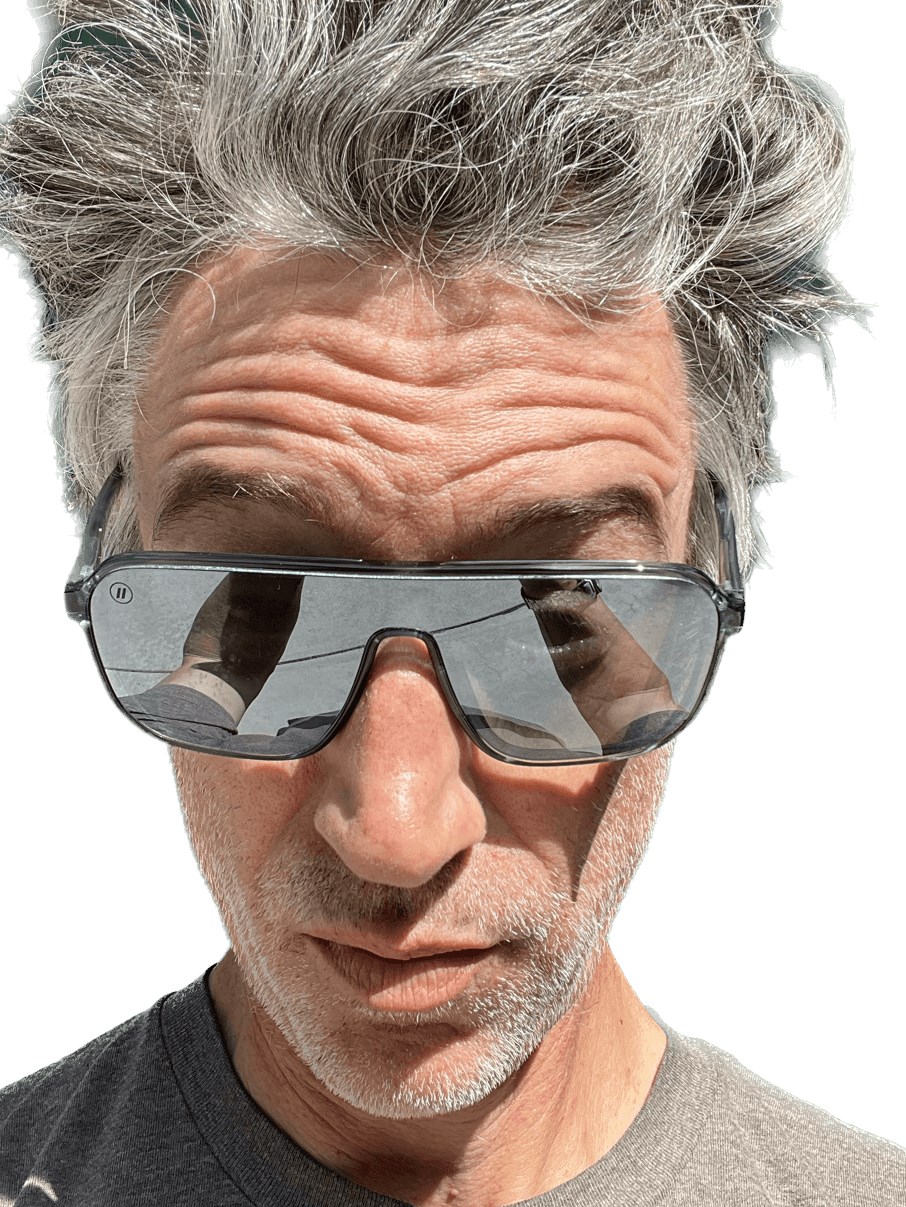 Daxxify Results After 1 Week Before