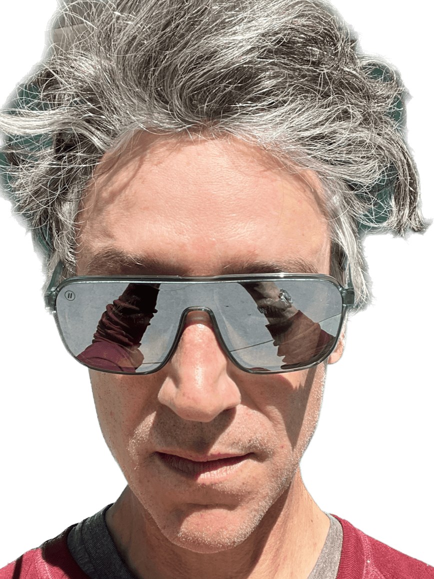 Daxxify Results After 1 Week After