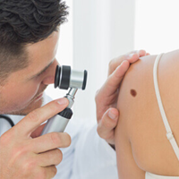 Skin Cancer and Mole Check
